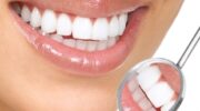 Мостовидные протезы высокого качества от «Стоматология Татьяны Коновой» — 5 преимуществ установки моста на зубы