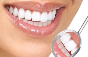 Мостовидные протезы высокого качества от «Стоматология Татьяны Коновой» — 5 преимуществ установки моста на зубы